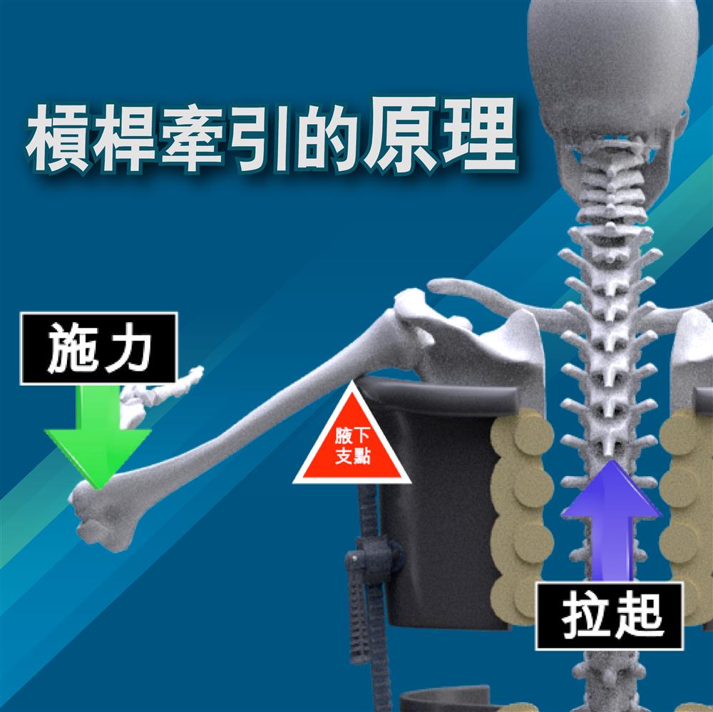 Medex. Herniated disc , Acute Sciatica , Facet Syndrome , Spinal Medex. Herniated disc , Acute Sciatica , Facet Syndrome , Spinal