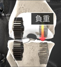 膝關節內側受負重示意圖