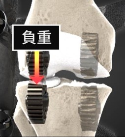 膝關節負重分布示意圖