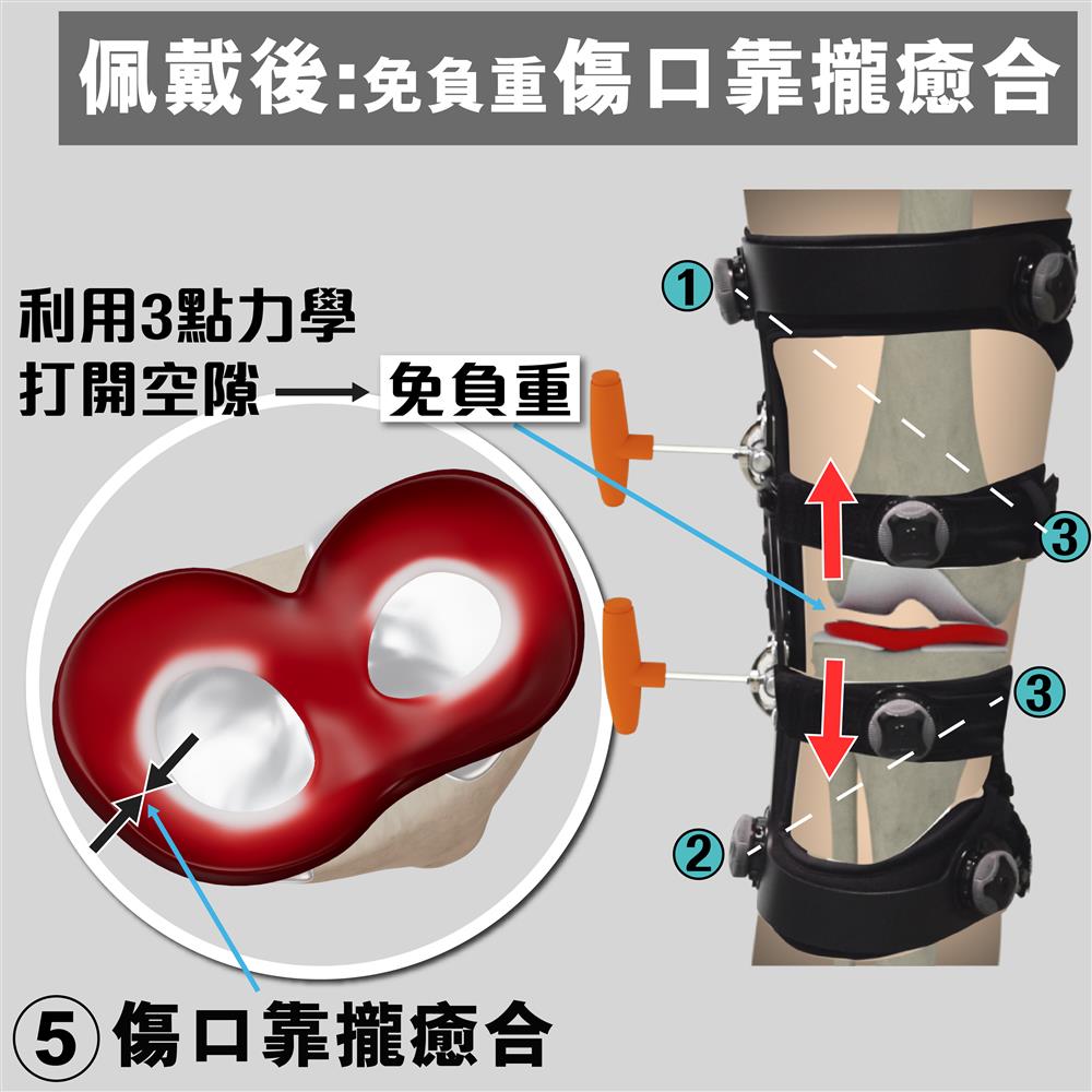 K39f - OA Unloading knee Brace K39f - OA Unloading knee Brace