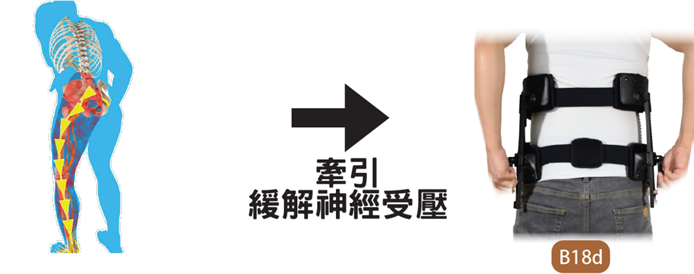 坐骨神經痛