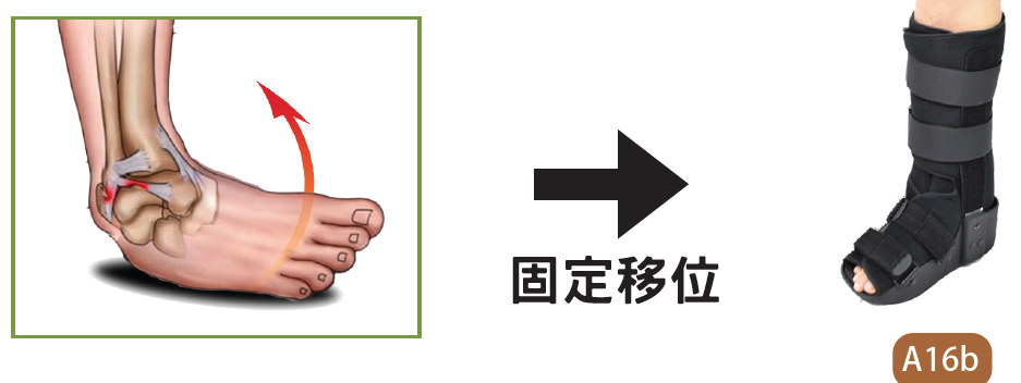 足踝扭傷