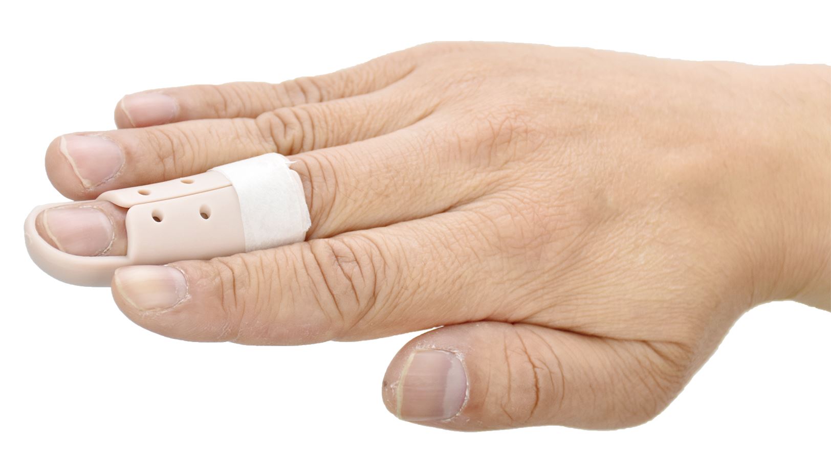 Medex. finger injured , finger pain , mallet finger due to rupture